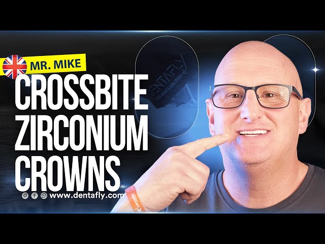 From Crossbite to a Perfect Smile! Mike’s Zirconium Crown Transformation