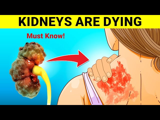 9 Warning Signs Your Kidneys Are Failing | Tests to Avoid Dialysis