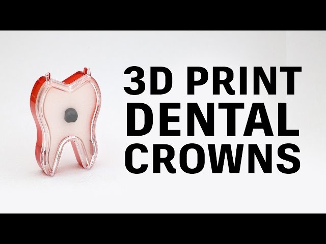 How to 3D print PFM dental crowns // Glidewell Laboratories