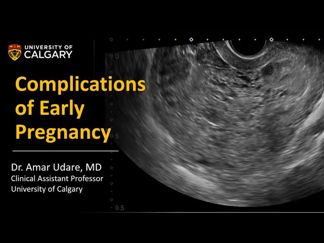 Early Pregnancy Ultrasound (First Trimester) - Normal Appearances and Complications