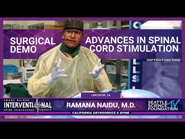 Advances in Spinal Cord Stimulation - Ramana Naidu, M.D.