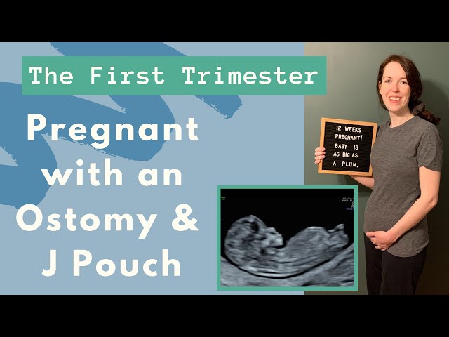 I'm Pregnant | First Trimester with an Ostomy and J Pouch