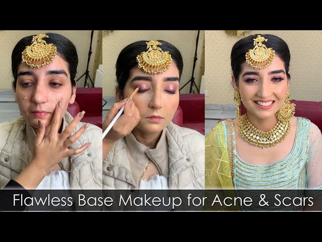 Flawless Base Makeup for Acne & Scars | Easy Makeup Transformation By Prabhleen Kaur Artistry