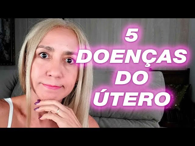 ❶ 5 【 Doenças Que Ocorrem No Útero 】 Endometriose  Miomas  Câncer No Colo Do Útero  Pólipos