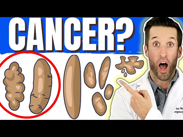 POOP 💩 What It Says About Your Health?