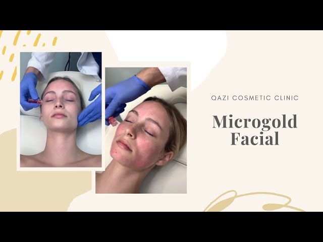 Microgold Facial using Botox infused with Essential Vitamins | Live with Dr. Nadir Qazi