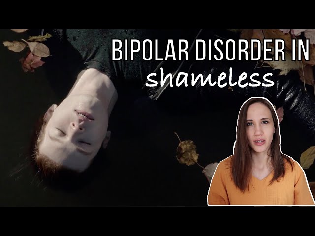 SHAMELESS — almost perfect portrayal of Bipolar Disorder