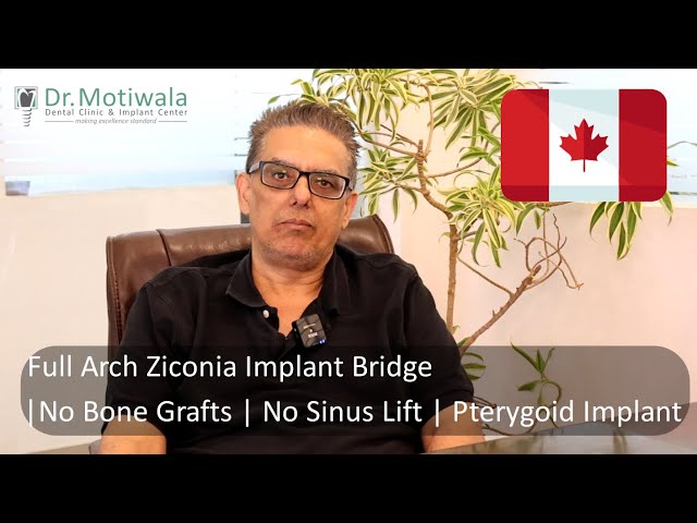 Basal Implant Review 11 years. Sarabjit changes to full arch zirconia bridge implant from PFM(metal)