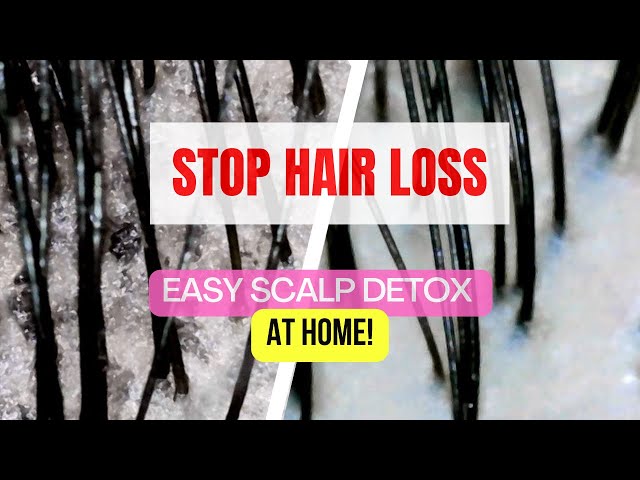 [KR SUB] Simple Ayurvedic Scalp Detox to Stop Hair Loss & Boost Growth