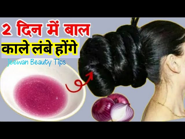 I swear, apply onion like this once! The real magic way to grow hair back 100%✅ from the roots, H...