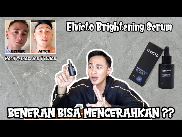 SERUM PRIA ELVICTO | BEGINI HASIL PEMAKAIAN 1 BULAN !