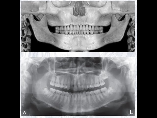 Panoramic Radiography Review