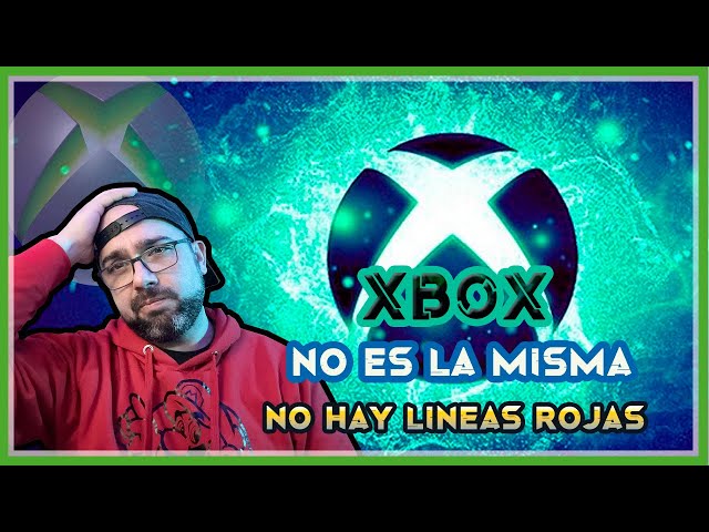 XBOX No es la misma | Cruzando las líneas rojas