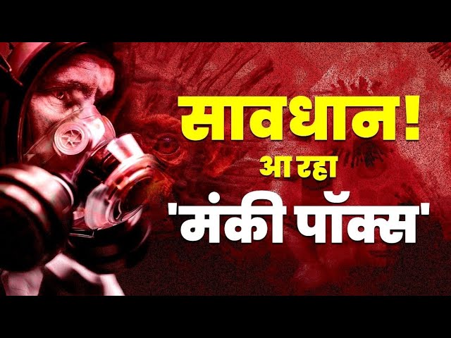 M pox virus news in india | M pox virus ke lakshan / Symptoms in hindi