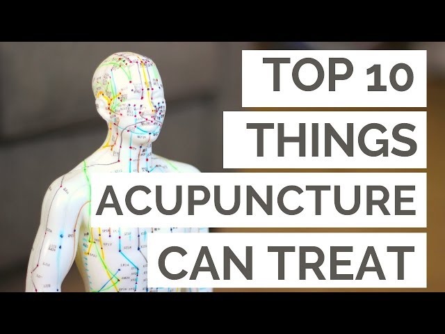 The Top 10 Conditions Acupuncture Can Help