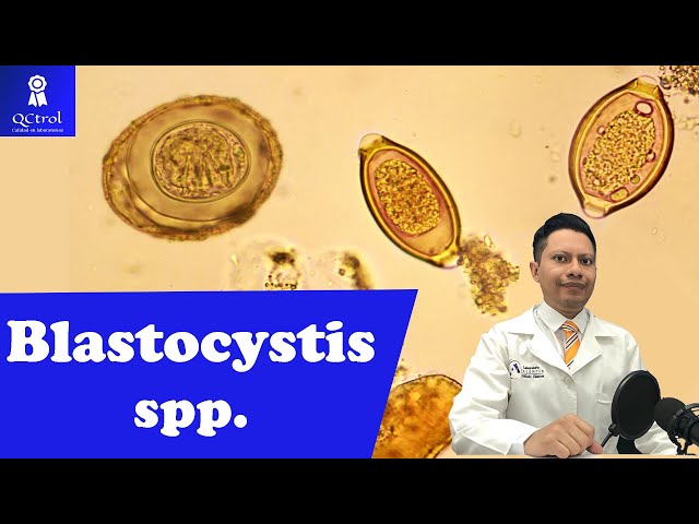 Meet Blastocystis spp: Mofology and CLUES for its identification, Parasitology Laboratory