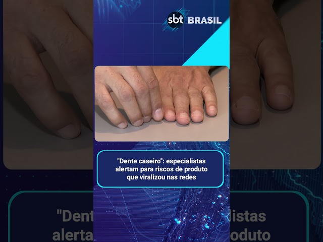 Venda de resinas em e-commerce é alvo de denúncia do Conselho de Odontologia | SBT Brasil (08/02/25)