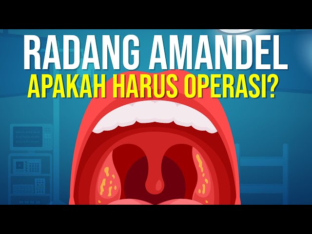 Radang Amandel, Apakah Harus di Operasi?