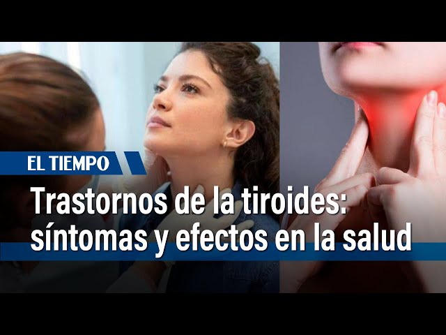 Endocrinóloga explica síntomas y efectos de los principales trastornos tiroideos | El Tiempo