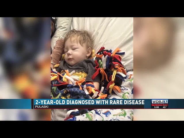 2-Year-Old Diagnosed With Rare Disease