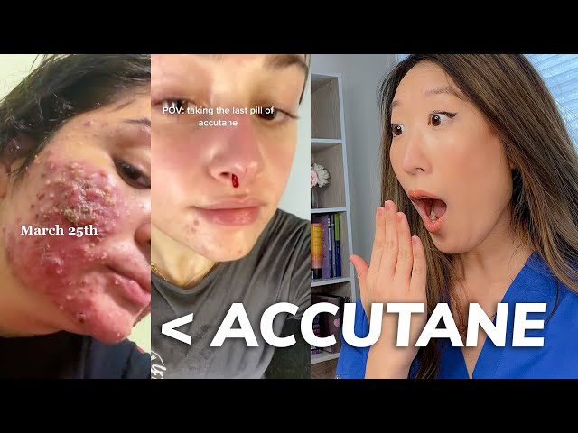 EVERYTHING you need to know about ACCUTANE: Dermatologist Explains