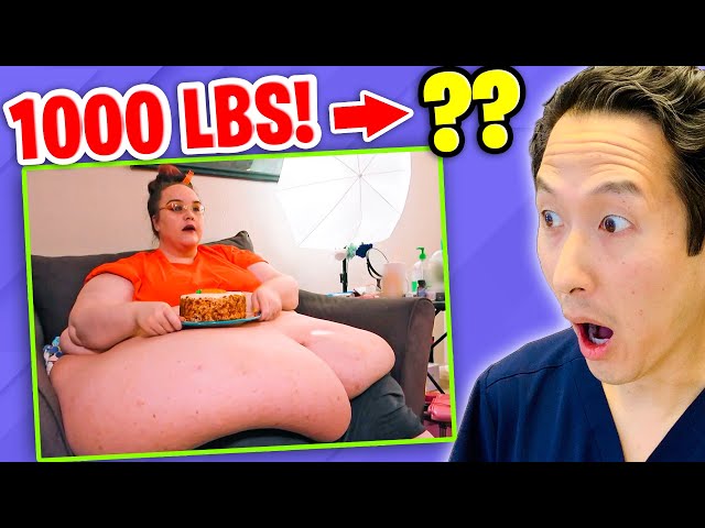 Plastic Surgeon Reacts to MY 600 LB LIFE! She went from 1000 lbs to ???