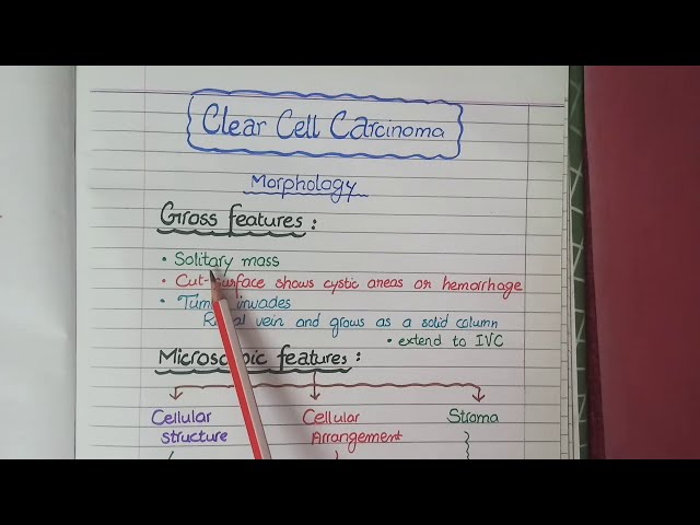 Renal Cell Carcinoma | Pathology