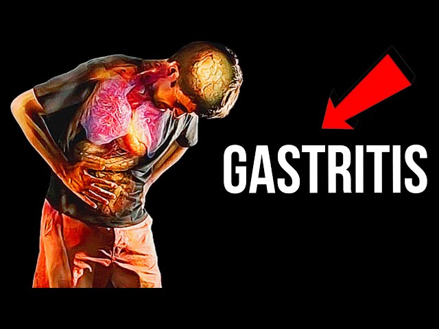 What You Must Know About Managing Gastritis: Key Insights for Better Digestive Health