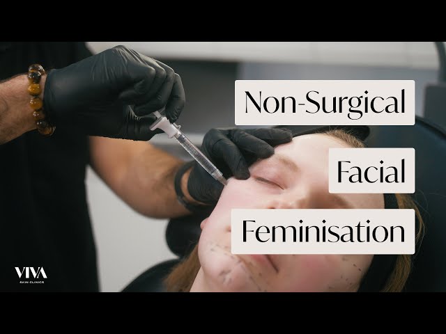 Full Face of Filler 🌈Feminisation | Trans woman | Natural Dermal Filler Before and After (2022)