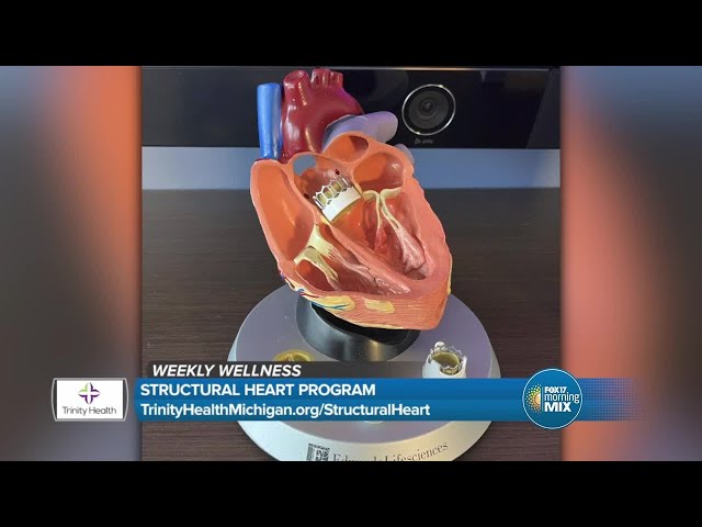 Weekly Wellness: Trinity Health's Structural Heart Program