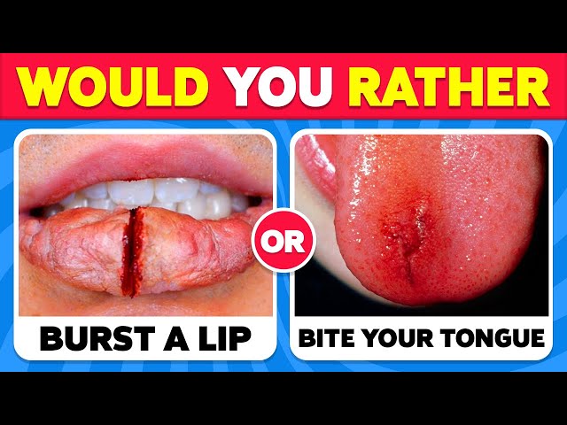 Would You Rather...? 100 HARDEST Choices Ever! 😱😨