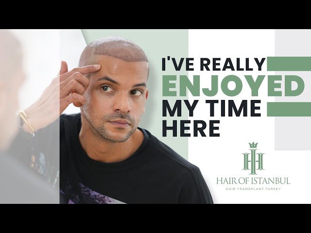 Juan's Hair Restoration Odyssey: From Chicago to Hair of Istanbul