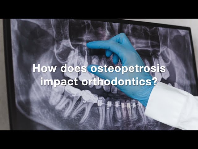 Pediatric dental health and osteopetrosis