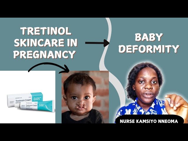 Deformity With Tretinol Skincare In Pregnancy