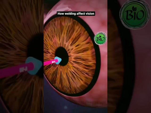 How welding affect eyes?😱| Biomedictation| #shorts #welding