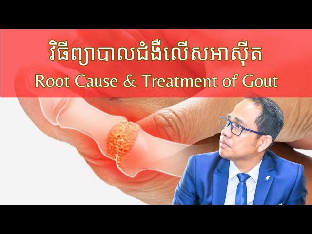 EP89: មូលហេតុលើសអាសុីត | Root Cause of Gout