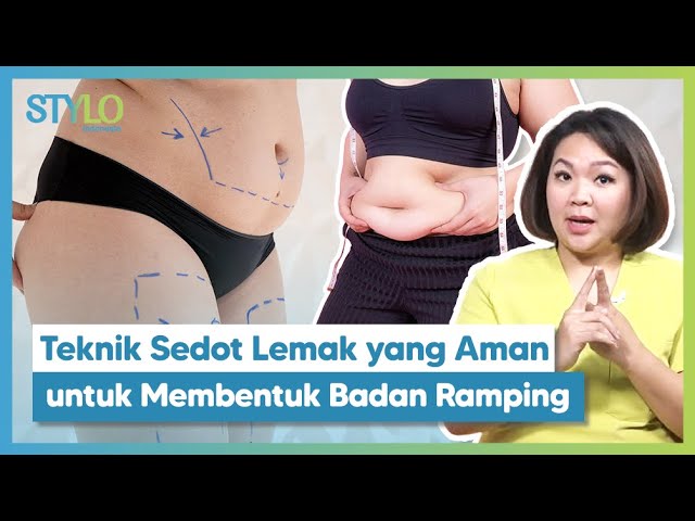 Proses Sedot Lemak yang Benar untuk Body Contour, Kata Dokter Kulit dari Perdoski