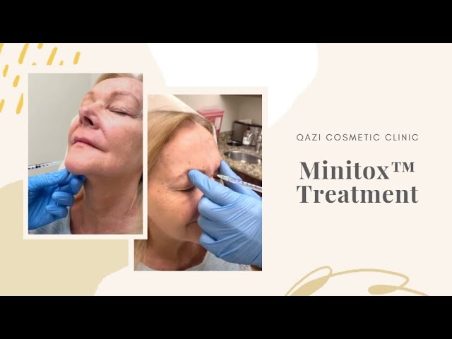 Signature Minitox™ Treatment | Live with Dr. Nadir Qazi