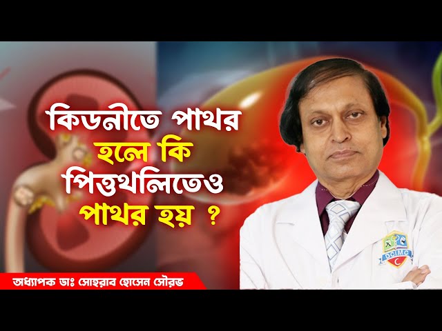 কিডনীতে পাথর হলে কি পিত্তথলিতেও পাথর হয় ? হাসপাতাল