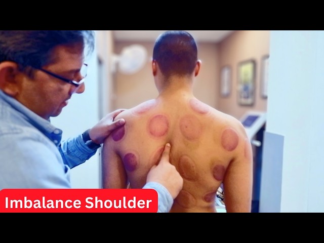 Shoulder Imbalance Correction Treatment | Dr Jeetu Mishra | Chiropractor | Delhi