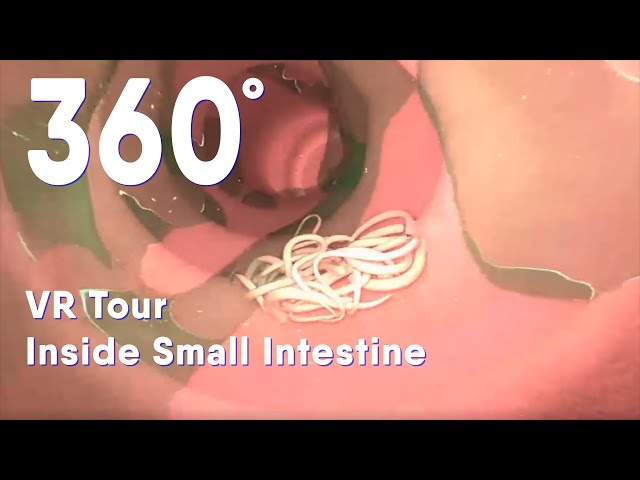 Small intestine with intestinal worms 360 VR |Intestinal Parasites |medical animation #intestin #360