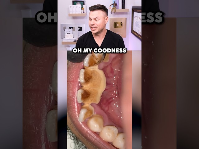 He Hasn’t Brushed His Teeth In YEARS! 😮🦷