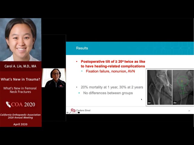 What's New in Femoral Neck Fractures - Carol Lin, MD, MA