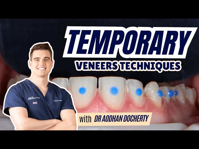 How to Temporise Veneers Step by Step FULL GUIDE - PDP214