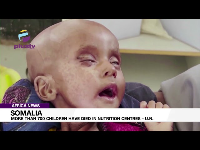 Somalia: More Than 700 Children Have Died In Nutrition Centres – U.N. | AFRICAN