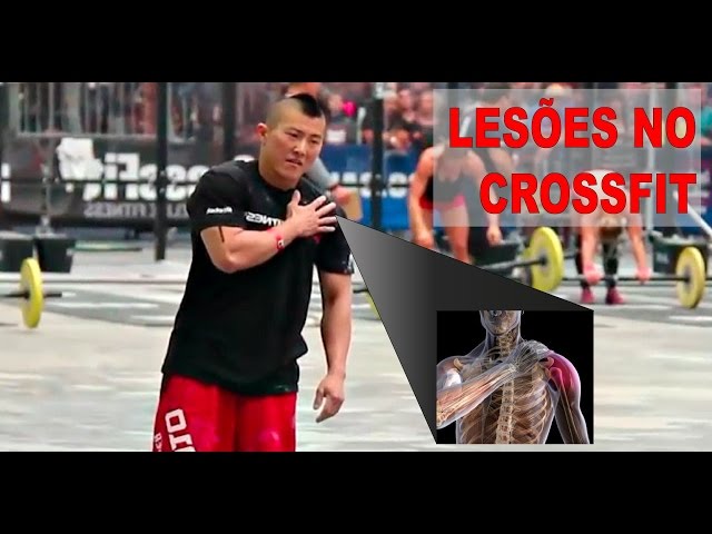 CrossFit machuca? (Lesões no CrossFit resenha de artigos)