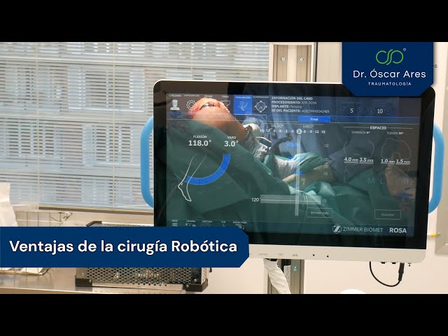 Ventajas de la cirugía Robótica - Dr. Oscar Ares