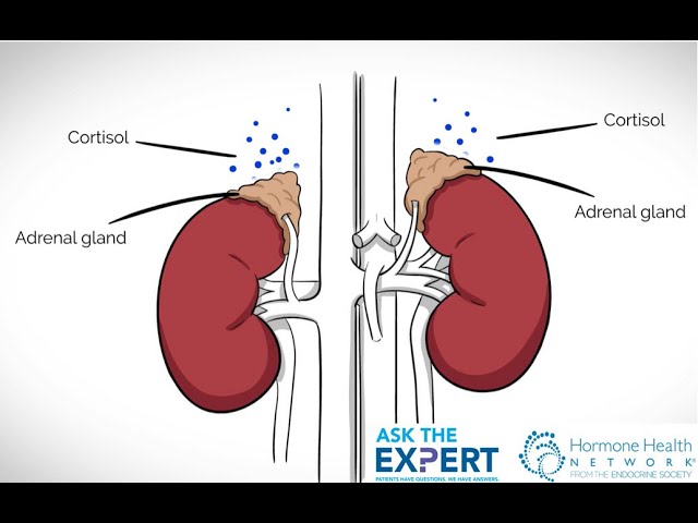 Ask The Expert -Truth About Adrenal Fatigue