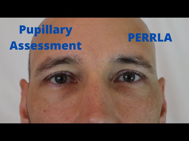 Pupillary Assessment (PERRLA)