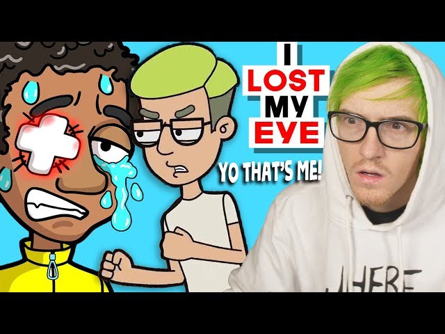 He "Lost His Eye" Wait is that me? - Reacting to "True Story" Animations